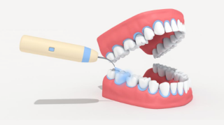 超声波洗牙的价格一般是多少，操作流程是怎样的？