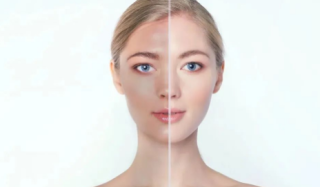 光子嫩肤会使皮肤变薄吗，敏感皮能做吗？