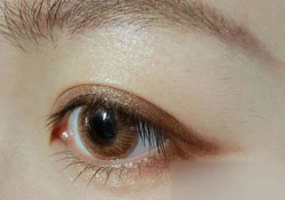 韩式定点双眼皮如何护理才能不留疤，术后伤口红肿发痒怎么办？