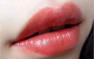 玻尿酸丰唇消肿可以热敷吗，嘴角玻尿酸和嘴唇玻尿酸的区别是什么？