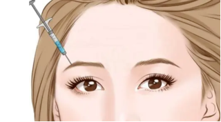 玻尿酸丰眉弓的操作方法是怎样的，纹眉后多久可以做？