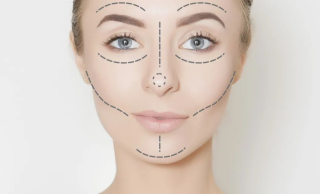 宽鼻矫正的切口有几种，术后护理工作要怎么做？