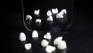 什么样的牙齿适合做瓷贴面，流程是怎样的？