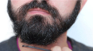 种植胡须的优势是什么，能维持多久？
