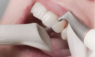 喷砂洗牙的过程是怎么做的，需要注意哪些事项？