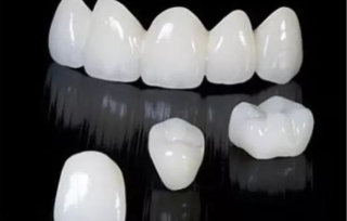 全瓷牙哪种种类最好，怎么制备基牙？