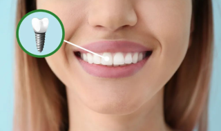 种植牙越贵越好吗，多久才能吃东西？
