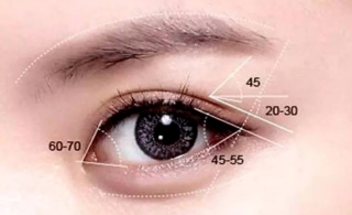 开外眼角手术有几种，术后护理需要注意哪些？
