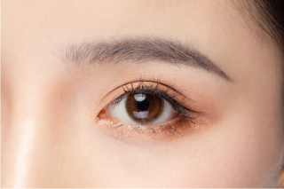 埋线双眼皮恢复需要多长时间，效果怎么样？